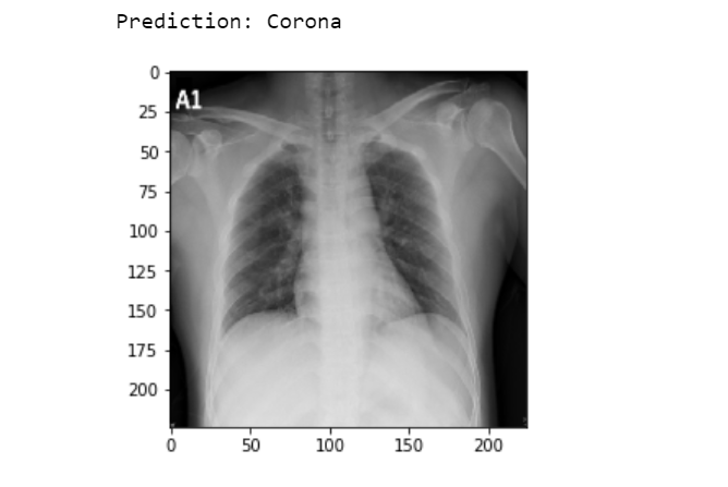 Detection of COVID-19 From Chest X-Ray Images Using Machine Learning